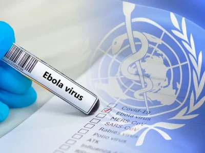 Salud Pública refuerza vigilancia epidemiológica ante alerta internacional por brote de ébola